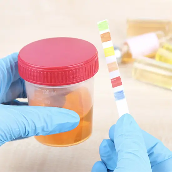 propoxyphene screen, urine test